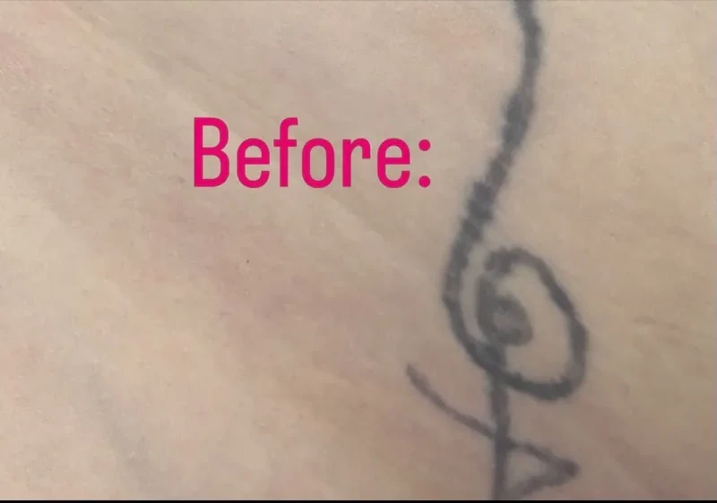 Before the cover-up on the ribs / side: A thin black rose-and-stem outline, heavily faded.
